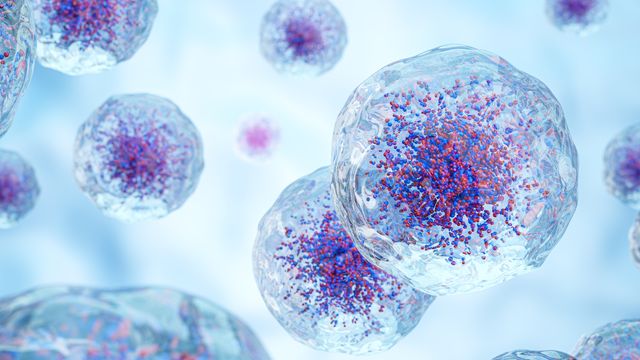 Breast Cancer Detection with Dimensionality Reduction